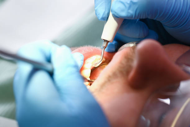 Best Emergency Dental Filling Replacement  in Orchard Grass Hills, KY