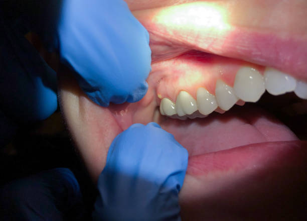 Best Broken Tooth Emergency  in Orchard Grass Hills, KY