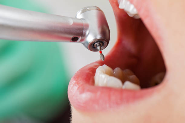 Best Tooth Infection Emergency Dentist  in Orchard Grass Hills, KY